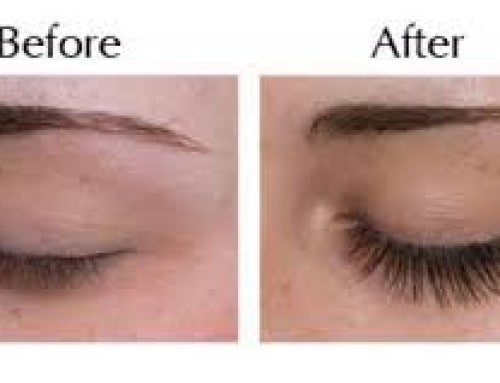 Eyelash Extensions Before After 3